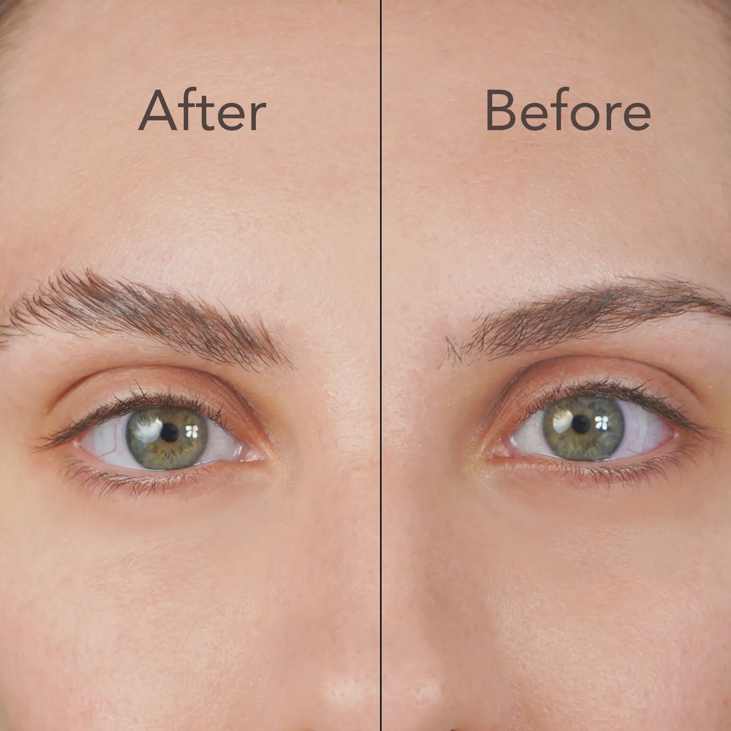 Fix my Brows